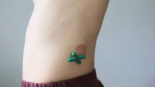 Egzama ve haç fotoğrafları