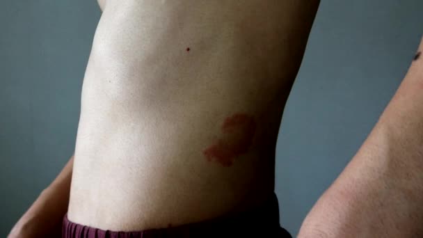 湿疹で拾う裸の男 — ストック動画
