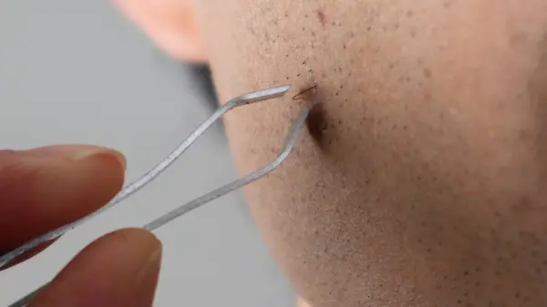 Japon adam sakalını çekiyor.