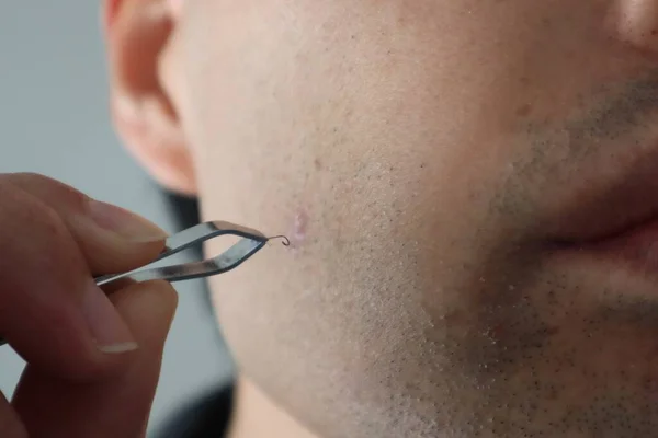 Bir adam cımbızla sakalını çekiyor.