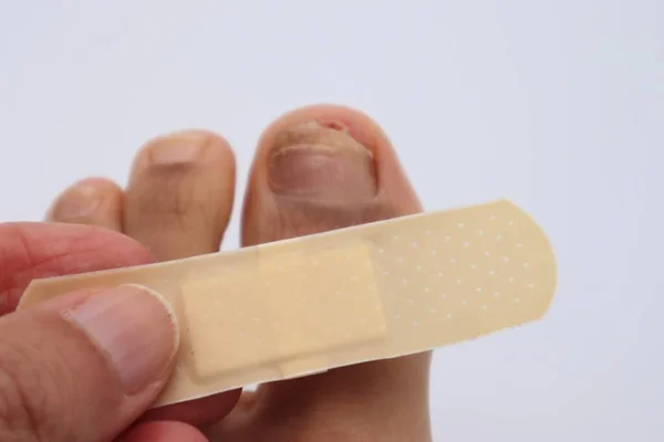 Ayak tırnağı yaralanmış biri.