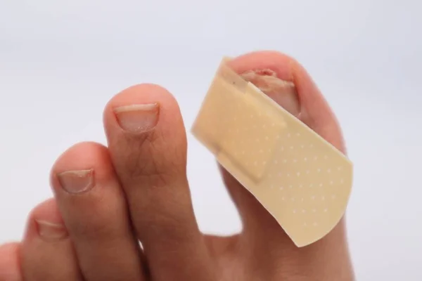 Ayak tırnağı yaralanmış biri.