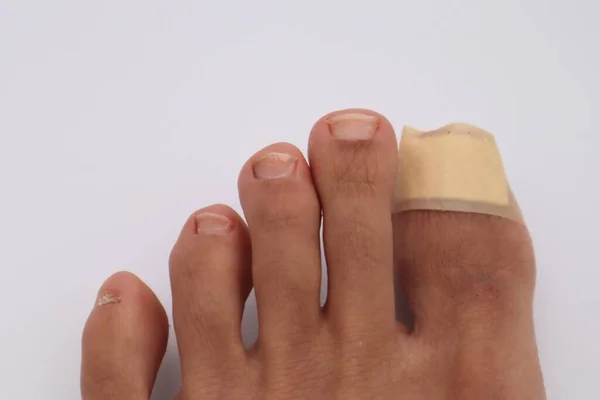 Bandajlı ayak parmağı