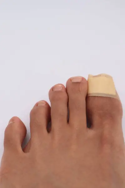 Bandajlı ayak parmağı