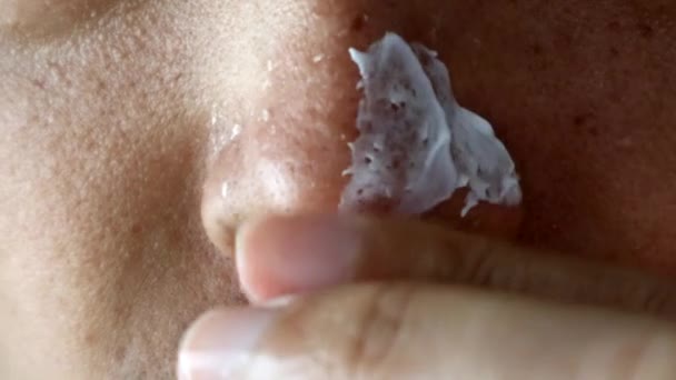 Japanese Man Applying Medicine His Sunburned Nose — Stock Video
