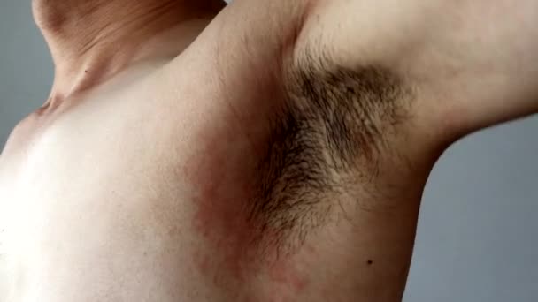 肌を傷つける日本人男性 — ストック動画