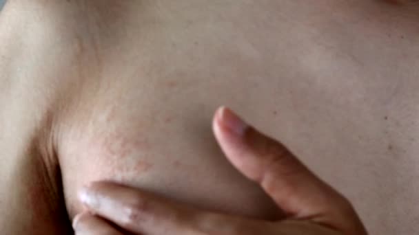 Japán Férfi Gyógyszert Alkalmaz Durva Bőrre — Stock videók
