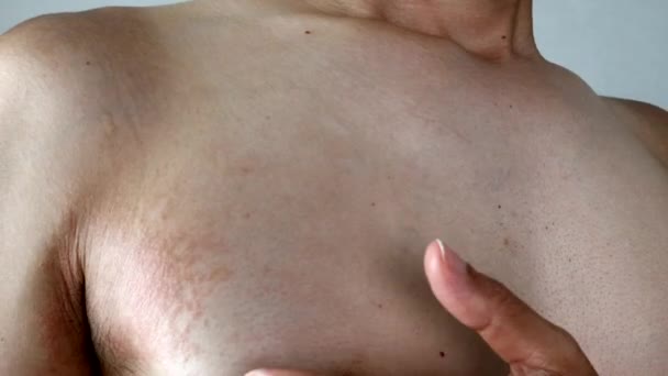 荒い肌をしている日本人男性 — ストック動画