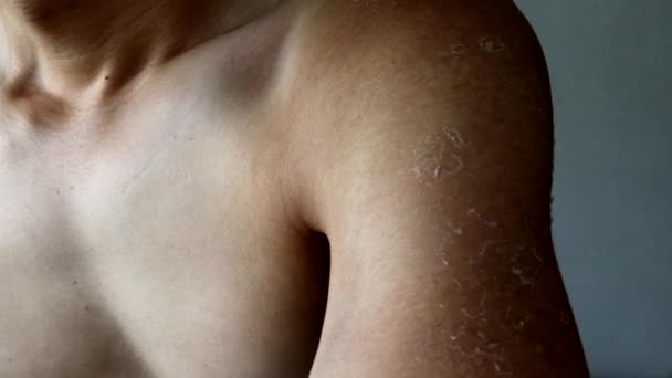 Japonská Člověk Scratching Jeho Opálený Kůže — Stock video