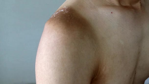Japanese Man Skin Peels Due Sunburn — Stock Video