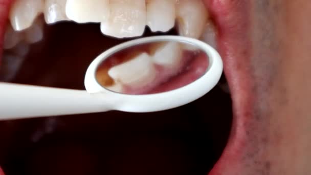悪い歯をした日本人男性 — ストック動画