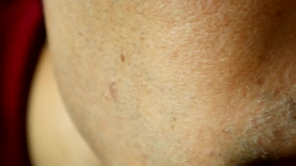 Японский Мужчина Указывает Вросшие Волосы Бороде — стоковое видео