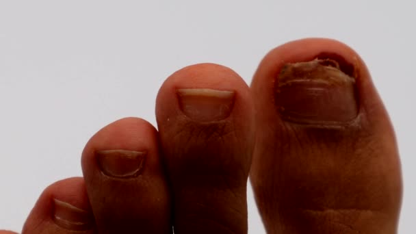 Άτομο Που Αγγίζει Τραυματισμένο Πόδι — Αρχείο Βίντεο