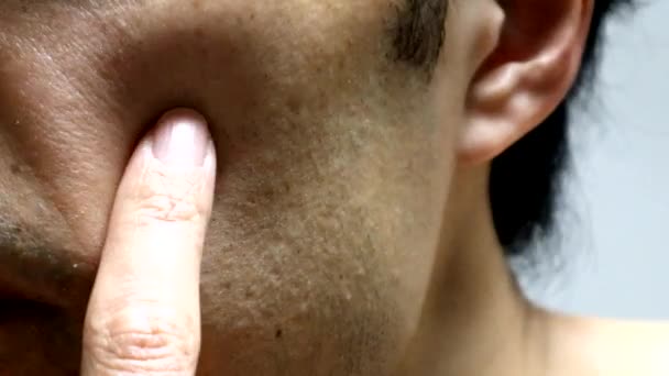 Video Van Een Persoon Die Zijn Huid Aanraakt — Stockvideo