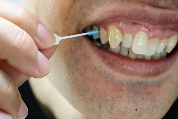 Diş aralarındaki boşlukları diş fırçasıyla temizleyen biri.