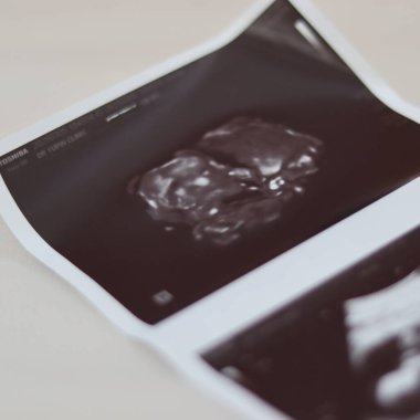 Annesinin karnında bir bebeğin ultrasonu..