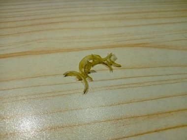 Kesildikten sonra tırnak ya da tırnak kesmek.