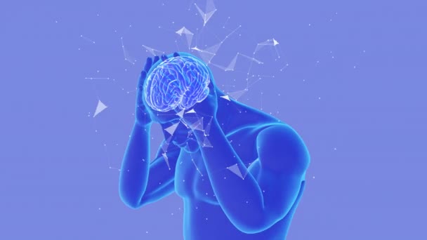 Animation Headache Migraine Plexus — ストック動画