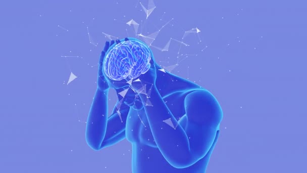 Animation Headache Migraine Plexus — 图库视频影像