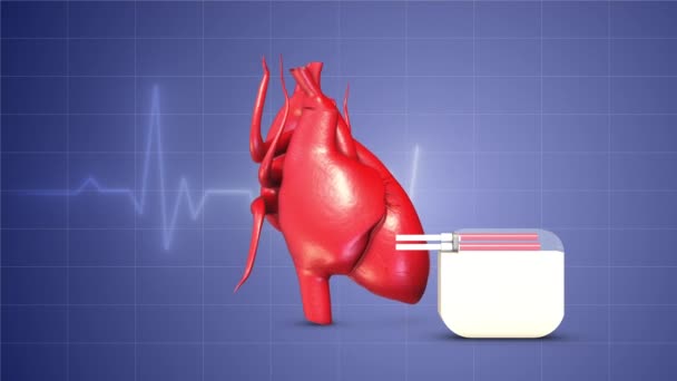 Herzschrittmacher Herzschlagwellenlinien — Stockvideo