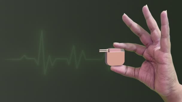 Пацемейкер Держащийся Руку Медицинской Концепцией Волны Сердцебиения — стоковое видео
