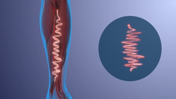 静脈瘤を有するヒトの脚 健康と病気の概念 — ストック動画