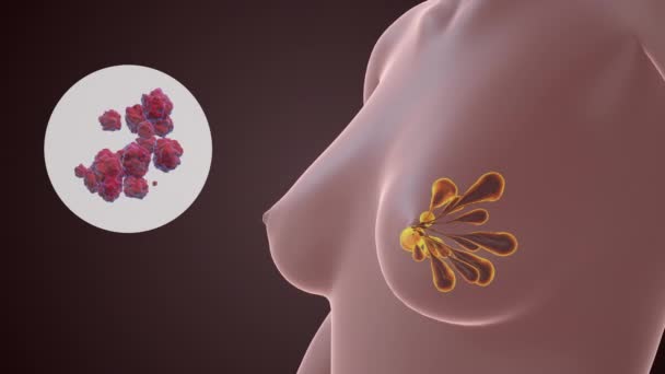 Visualisation Conceptuelle Des Cellules Cancéreuses Sein — Video
