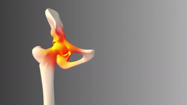 人間の痛みを伴う腰の医療コンセプト — ストック動画