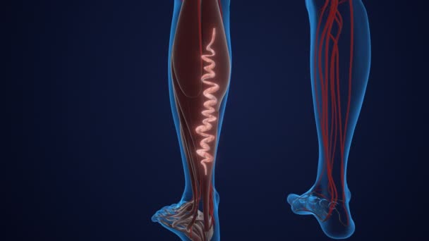 Vasküler Hastalık Toplardamar Yetersizliği Bacaktaki Varis Damarları — Stok video
