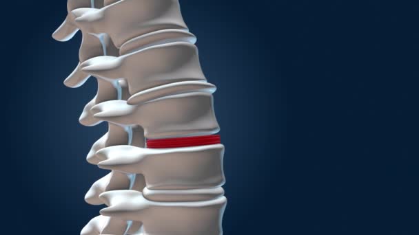 Estabilização Coluna Vertebral Com Implantes Lombares — Vídeo de Stock
