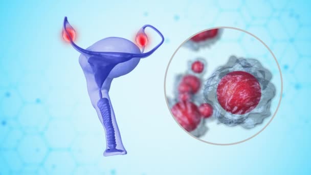Ovarium Yang Terinfeksi Sistem Reproduksi Wanita — Stok Video