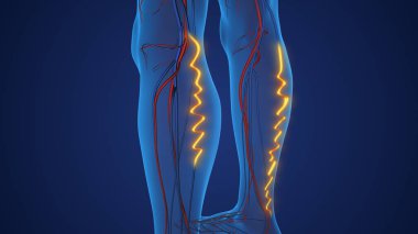 Bacakları bükülmüş varisli.