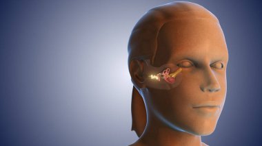 Kulak kiri enfeksiyonu Tıbbi konsept