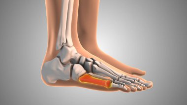 Metastaz kırmızısı acı yakar ve karıncalanır.