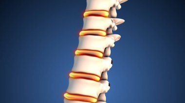 İnsan omurgası acı tıbbi konsepti