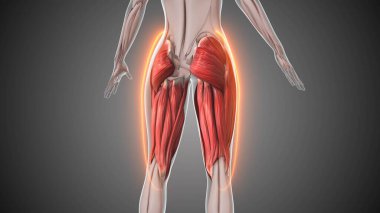 Bacak ağrısı için tıbbi animasyon..