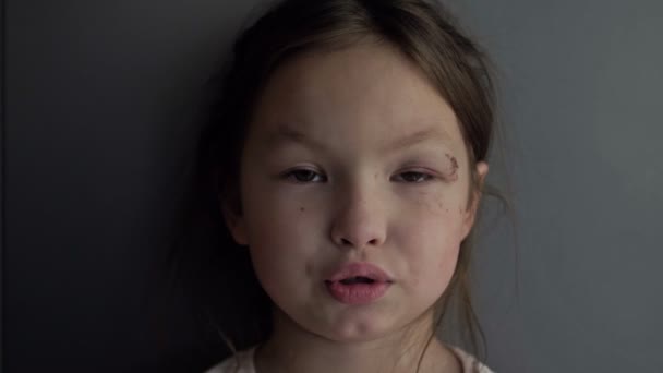Una Bambina Anni Una Ferita Dolorosa Livido Vicino All Occhio — Video Stock