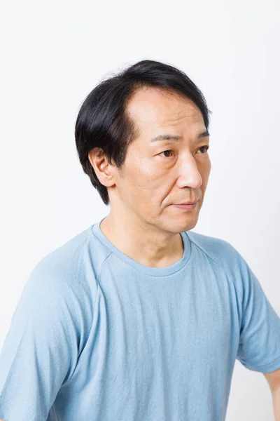 有脱发问题的日本男人 — 图库照片