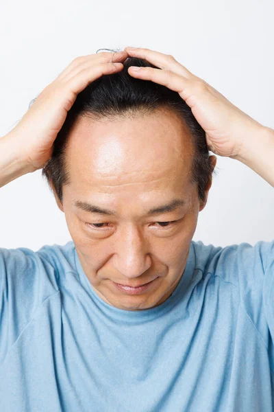 Starší Japonský Muž Problémem Vypadávání Vlasů — Stock fotografie