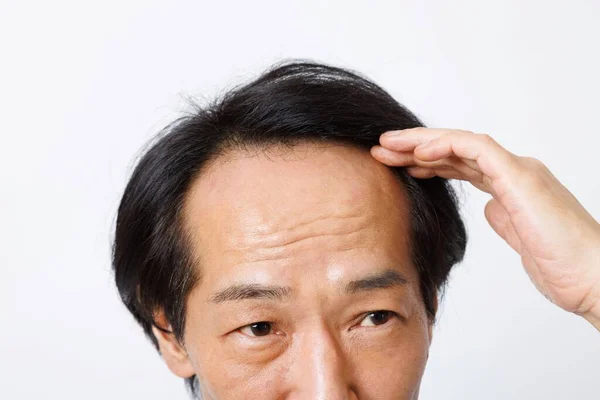 Homme Japonais Mature Avec Problème Perte Cheveux — Photo