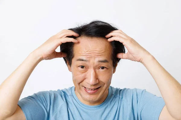 Dojrzałe Japoński Człowiek Wypadanie Włosów Problem — Zdjęcie stockowe