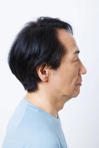 Dojrzałe Japoński Człowiek Wypadanie Włosów Problem — Zdjęcie stockowe