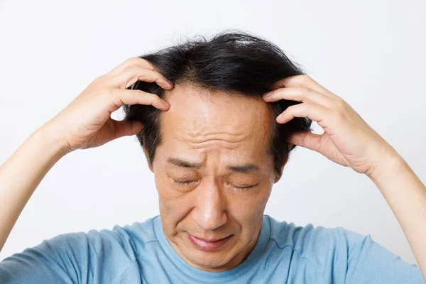 Starší Japonský Muž Problémem Vypadávání Vlasů — Stock fotografie