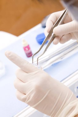 Beyaz eldivenli doktor elleri kıskaç kullanıyor.