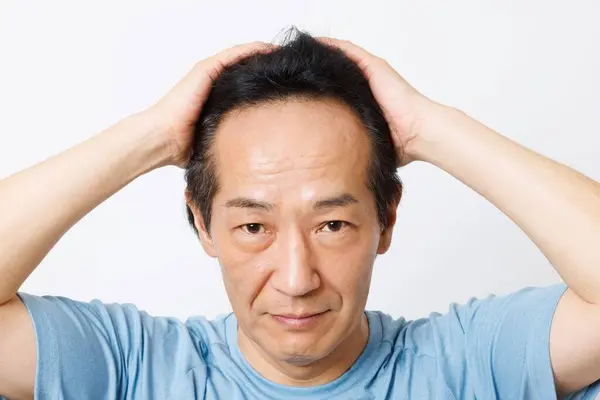 脱毛問題を抱えているアジアのシニア男性の肖像画 — ストック写真