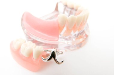 Öğrencilerin dişlerini gösteren eğitim modelini öğrenmeleri için implant ve ortodontik model