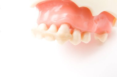 Öğrencilerin dişlerini gösteren eğitim modelini öğrenmeleri için implant ve ortodontik model