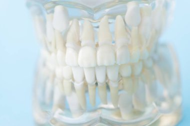 Diş modeli, diş modeli, dişçilik kavramı