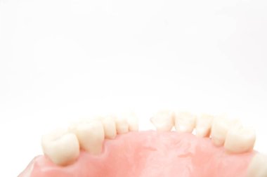 Öğrencilerin dişlerini gösteren eğitim modelini öğrenmeleri için implant ve ortodontik model