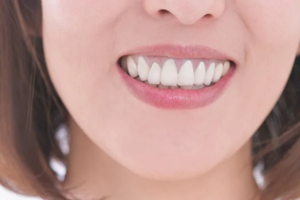 Närbild Skott Vackra Mogna Japanska Kvinna Vitare Tänderna Vit Bakgrund — Stockfoto